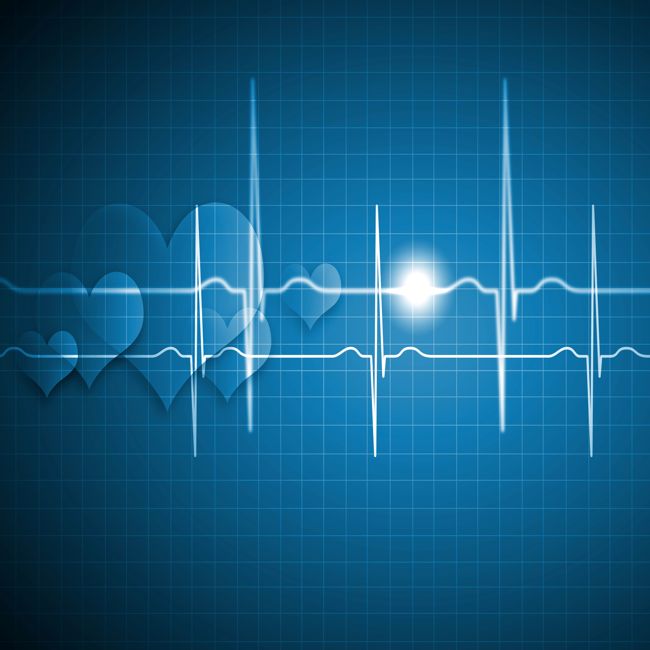 Tegen ernstige hartritmestoornissen werkt een nieuw systeem boven verwachting